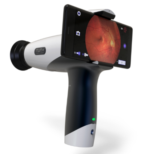 Fundus-Camera-NUN+.jpg